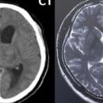 ct と mri の違い：医療画像診断におけるそれぞれの特長と利点