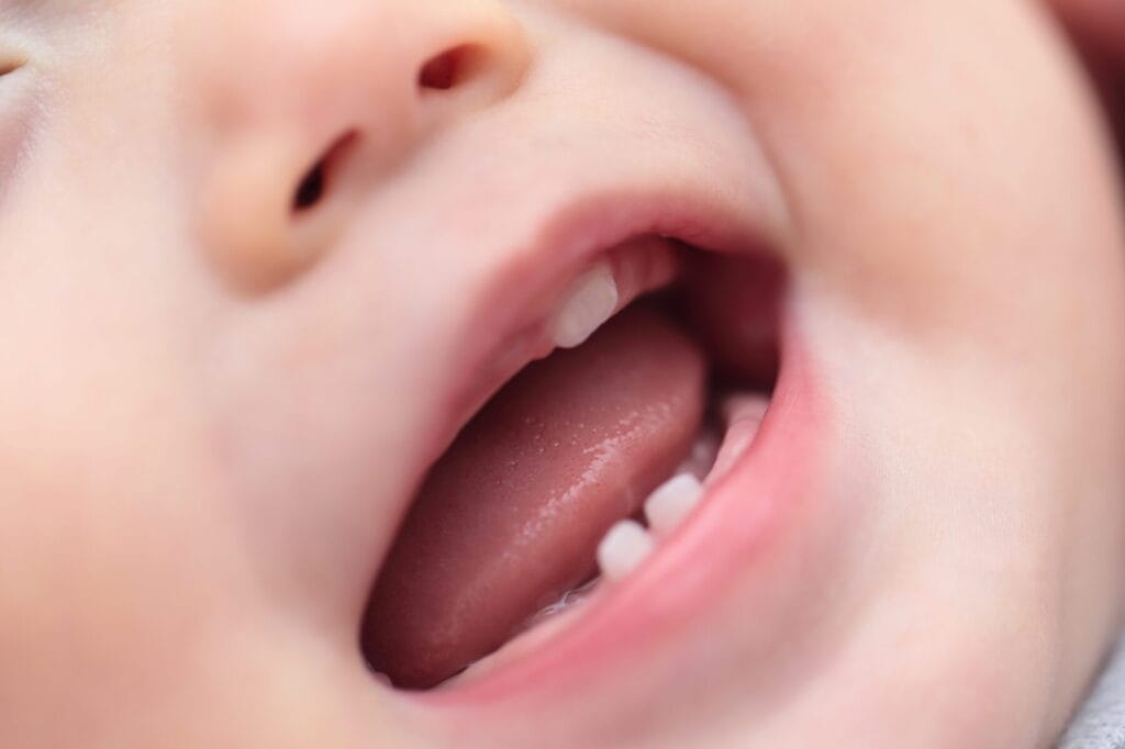 「乳歯と永久歯の違いを徹底解説!知っておきたい特徴と成長過程」