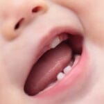 「乳歯と永久歯の違いを徹底解説！知っておきたい特徴と成長過程」