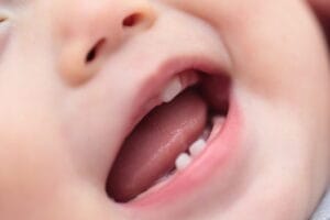 「乳歯と永久歯の違いを徹底解説！知っておきたい特徴と成長過程」