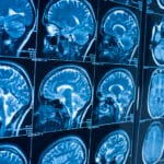 MRI と MRA の違い：それぞれの特徴と用途を徹底解説！